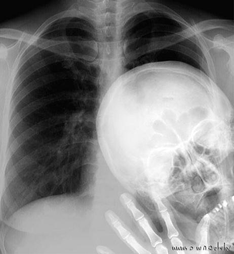 Funny x-ray