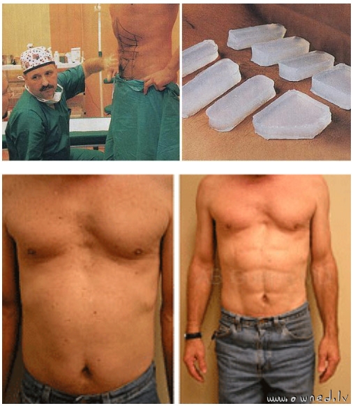 Silicone six pack